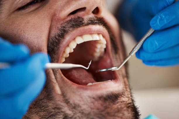 Best Emergency Dental Care for Abscessed Tooth in Twain Harte, CA